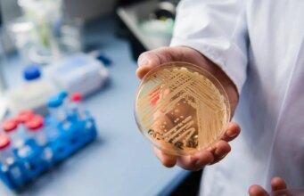 Un “superbatterio” mortale si sta diffondendo negli Stati Uniti man mano che cresce la resistenza ai farmaci, avvertono i ricercatori