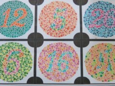 Uno strano legame tra daltonismo e cancro alla vescica potrebbe effettivamente avere perfettamente senso