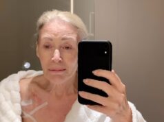 Angie Finest, 73 anni, pubblica un aggiornamento sulla chemioterapia dopo aver viaggiato in Svizzera per un trattamento non convenzionale contro il vischio nella sua battaglia contro il cancro al colon