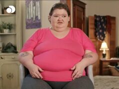 La star di Sisters da 1000 libbre Amy Slaton corregge l’occhio pigro con un intervento chirurgico e mostra risultati drammatici