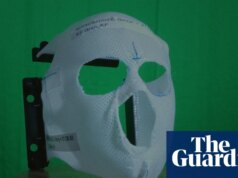 “Una guerra civile permanente nel corpo”: come la lotta contro il cancro ha aiutato un artista a comprendere la sua giovinezza sovietica