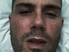 Max George di The Needed afferma di non avere thought di cosa stia succedendo nell’aggiornamento dopo essere stato portato d’urgenza in ospedale