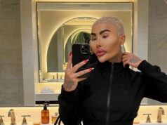 Due arrestati dopo la morte della star televisiva ossessionata da Kardashian, chiamata “Lip King” della Gran Bretagna