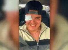 Perde la vista del figlio dell’uomo fino a 24 anni durante una partita di hockey