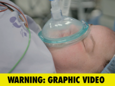 La star di “Sorelle da 1000 libbre” Amy si sottopone a un intervento chirurgico per correggere l’occhio pigro, in video