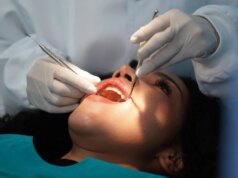 Medicaid sta pagando più remedy odontoiatriche. I tagli al GOP minacciano di invertire la tendenza.