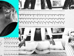 La tecnologia sta rimodellando il trattamento dell’apnea notturna