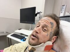 Jelly Roll rivela di aver partecipato ai Grammy del 2026 con una clavicola rotta dopo un incidente con l’ATV