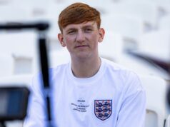 Offended Ginge rivela come è cambiata la vita dopo la vittoria di I am A Celeb come confermato dal ritorno di Soccer Assist