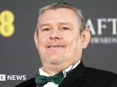 Saturday Evening Stay è stato criticato per lo sketch “dannoso” di Tourette