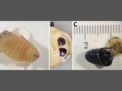Una donna viene infestata dai vermi e li starnutisce