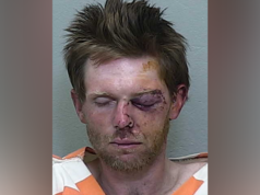 Sospettato armato di ascia sottomesso dall’uccisione MMA di una giovane recluta militare durante uno scontro in un autolavaggio ripreso in video