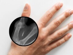 I microchip sottocutanei obbligatori per i dipendenti potrebbero presto essere vietati nello Stato di Washington